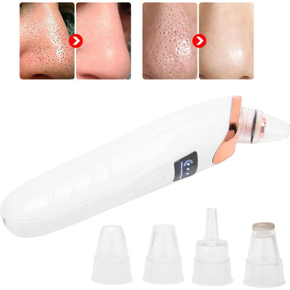 Blackhead Remover Vacuum Facial Pore™ | Cleaner Electric Acne