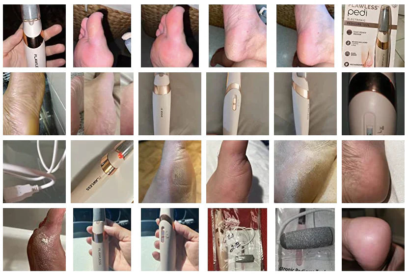 Rough Skin Remedy™ | Electric foot Callus Remover