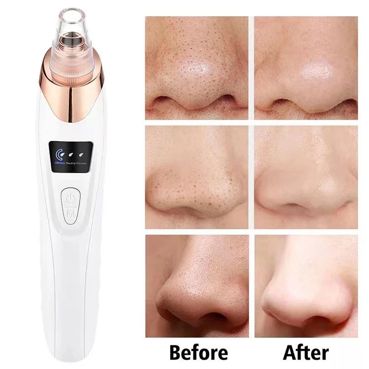 Blackhead Remover Vacuum Facial Pore™ | Cleaner Electric Acne