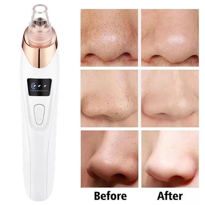 Blackhead Remover Vacuum Facial Pore™ | Cleaner Electric Acne